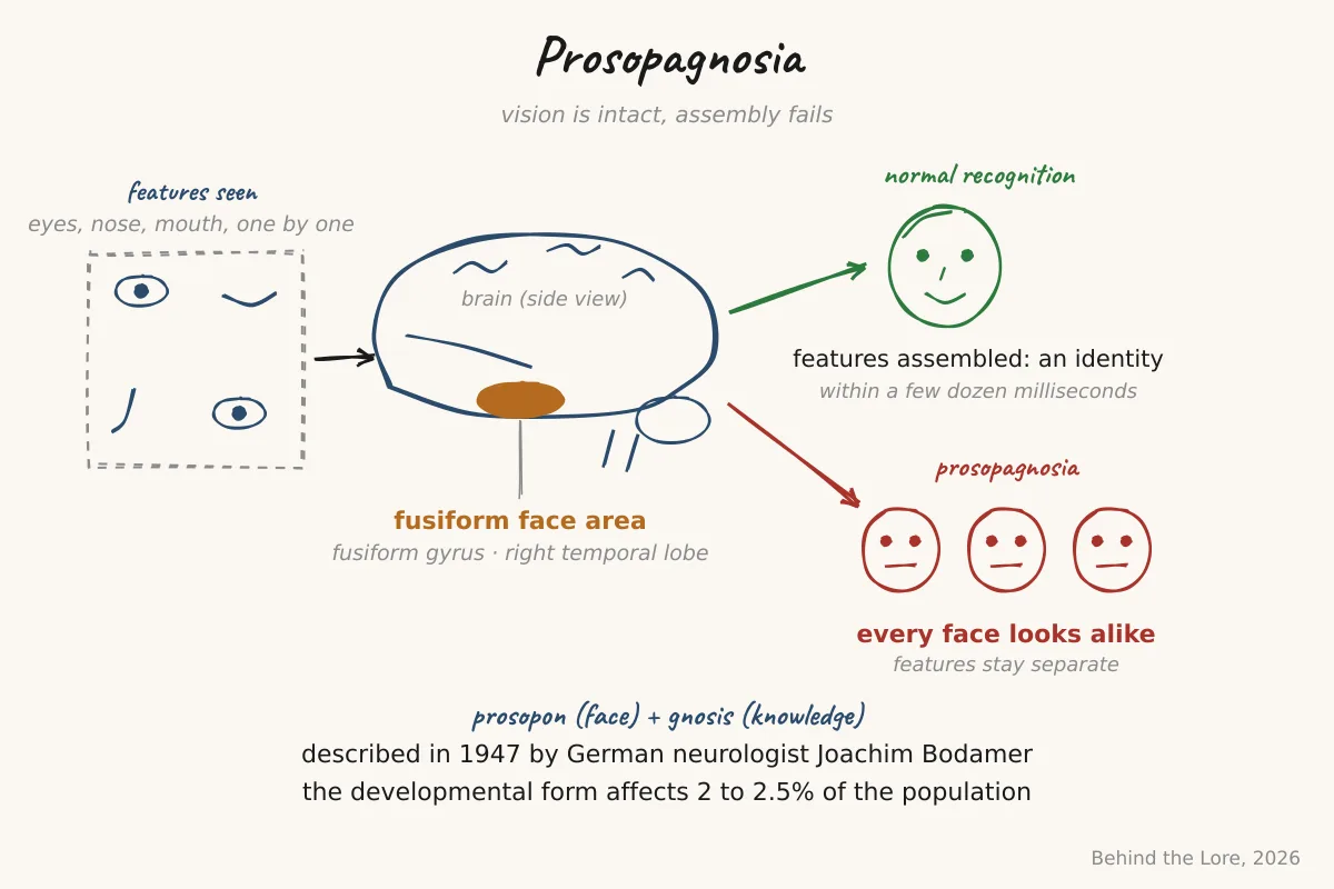 Diagram of the fusiform face area in the temporal lobe and illustration of prosopagnosia