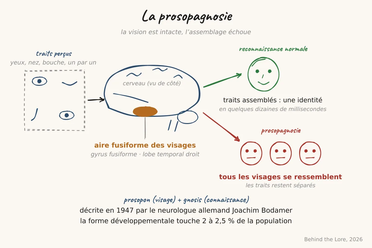 Schéma de l'aire fusiforme des visages dans le lobe temporal et illustration de la prosopagnosie