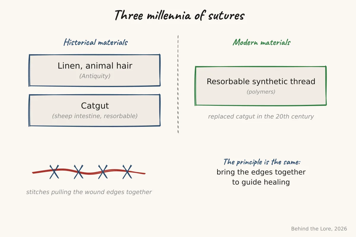 Comparative diagram of historical suture materials (linen, catgut) and modern ones (resorbable synthetic thread), with a drawing of a surgical knot
