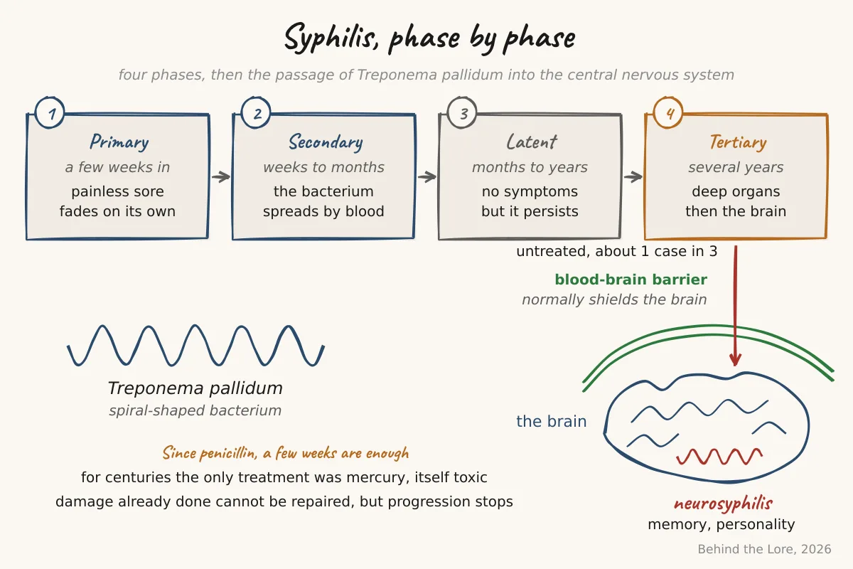 Diagram of the four phases of syphilis and the passage of Treponema pallidum into the brain