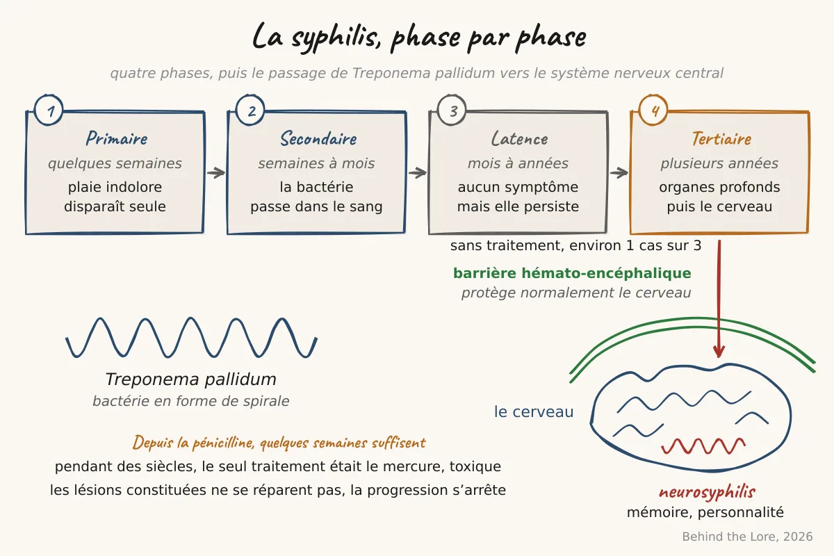 Schéma des quatre phases de la syphilis et du passage de Treponema pallidum dans le cerveau